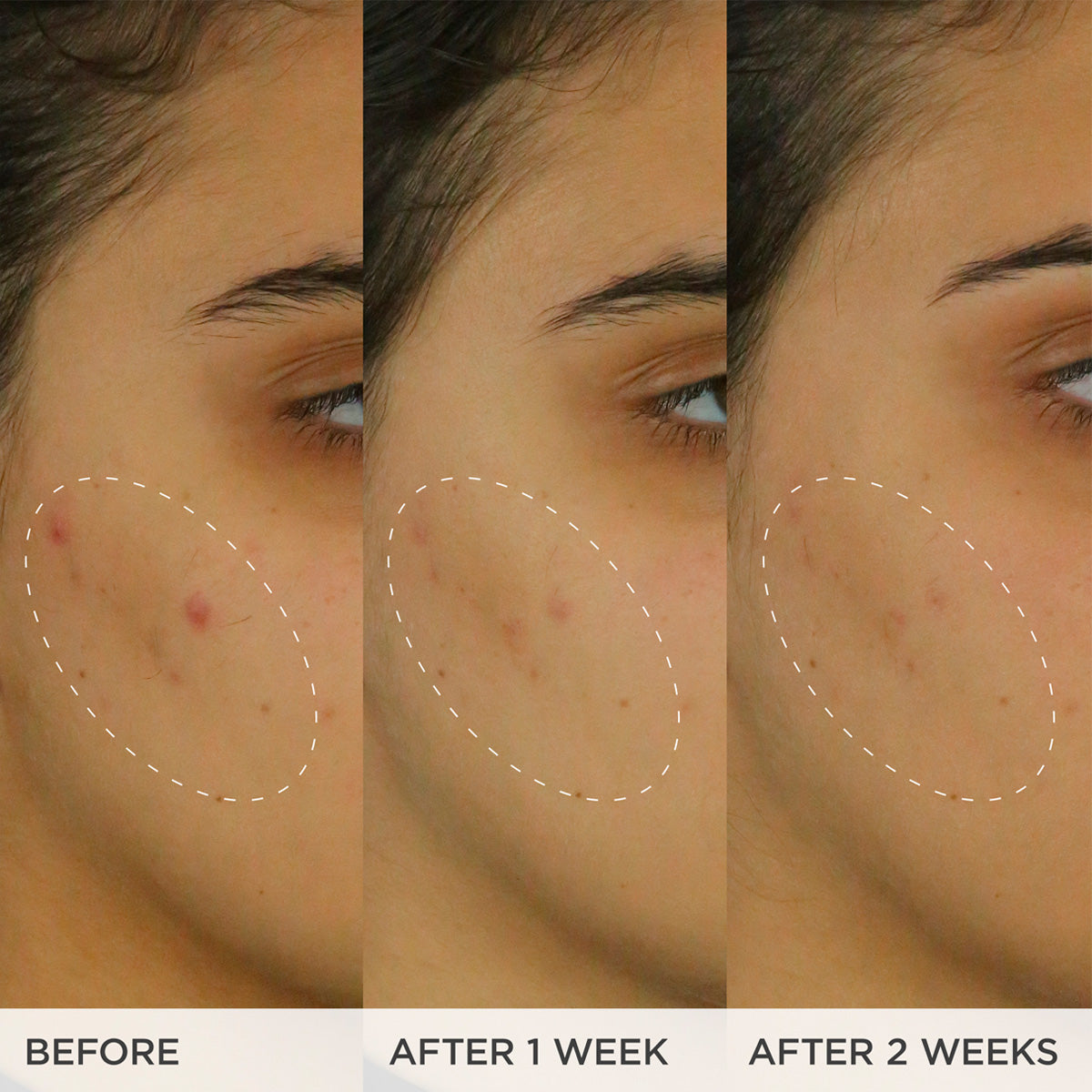 The Brightening Serum