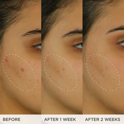 The Brightening Serum