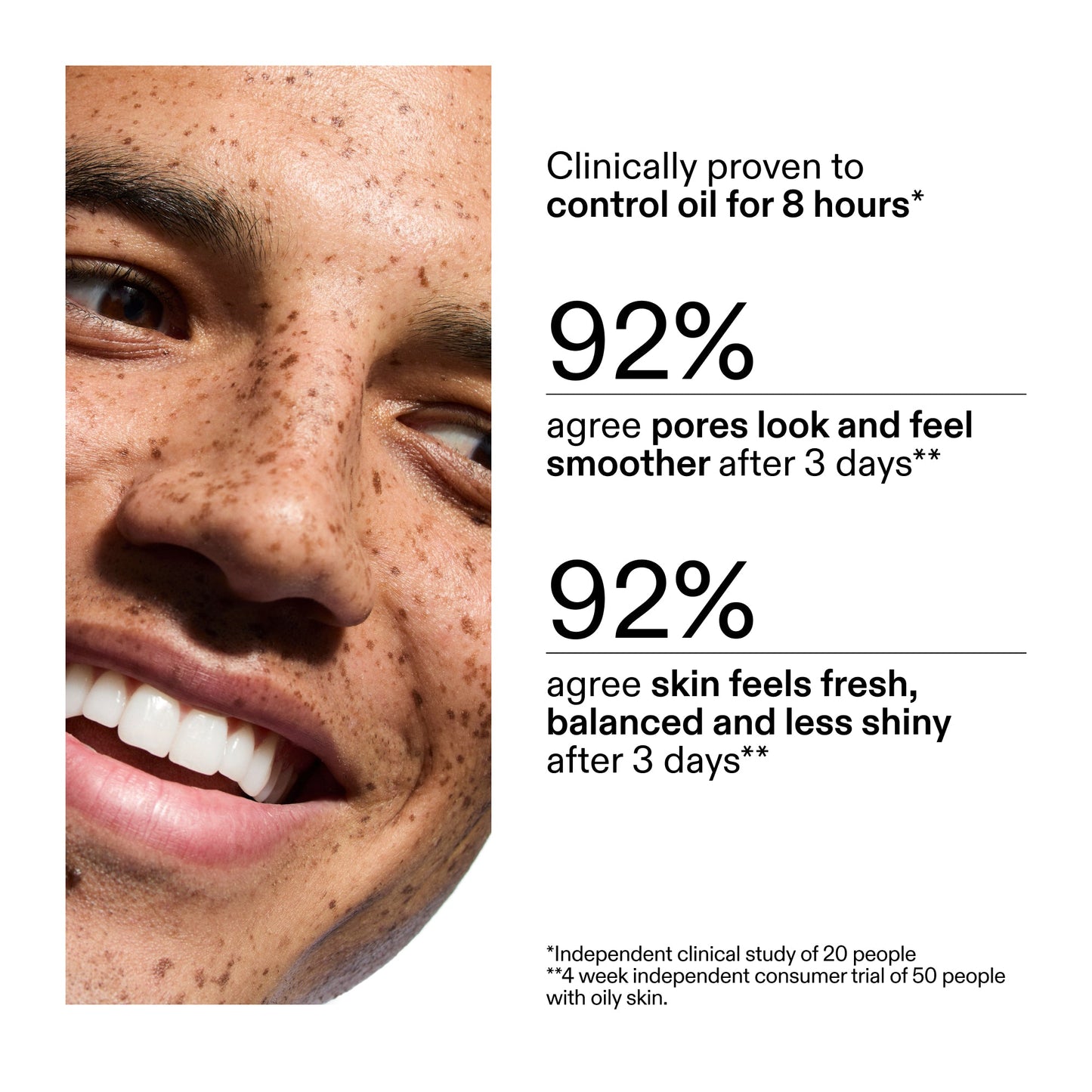 20% Niacinamide Serum