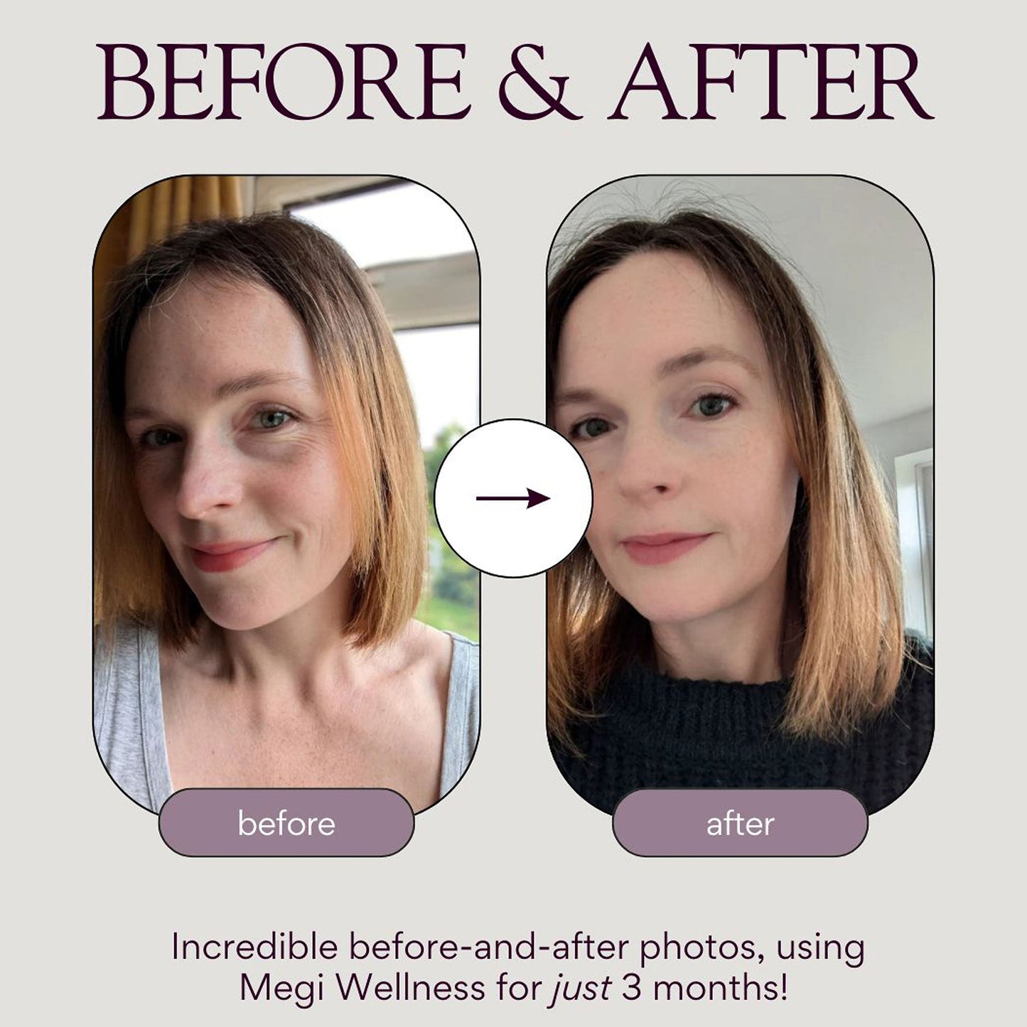 Megi Wellness Fortifying & Deep Nourishing Conditioner