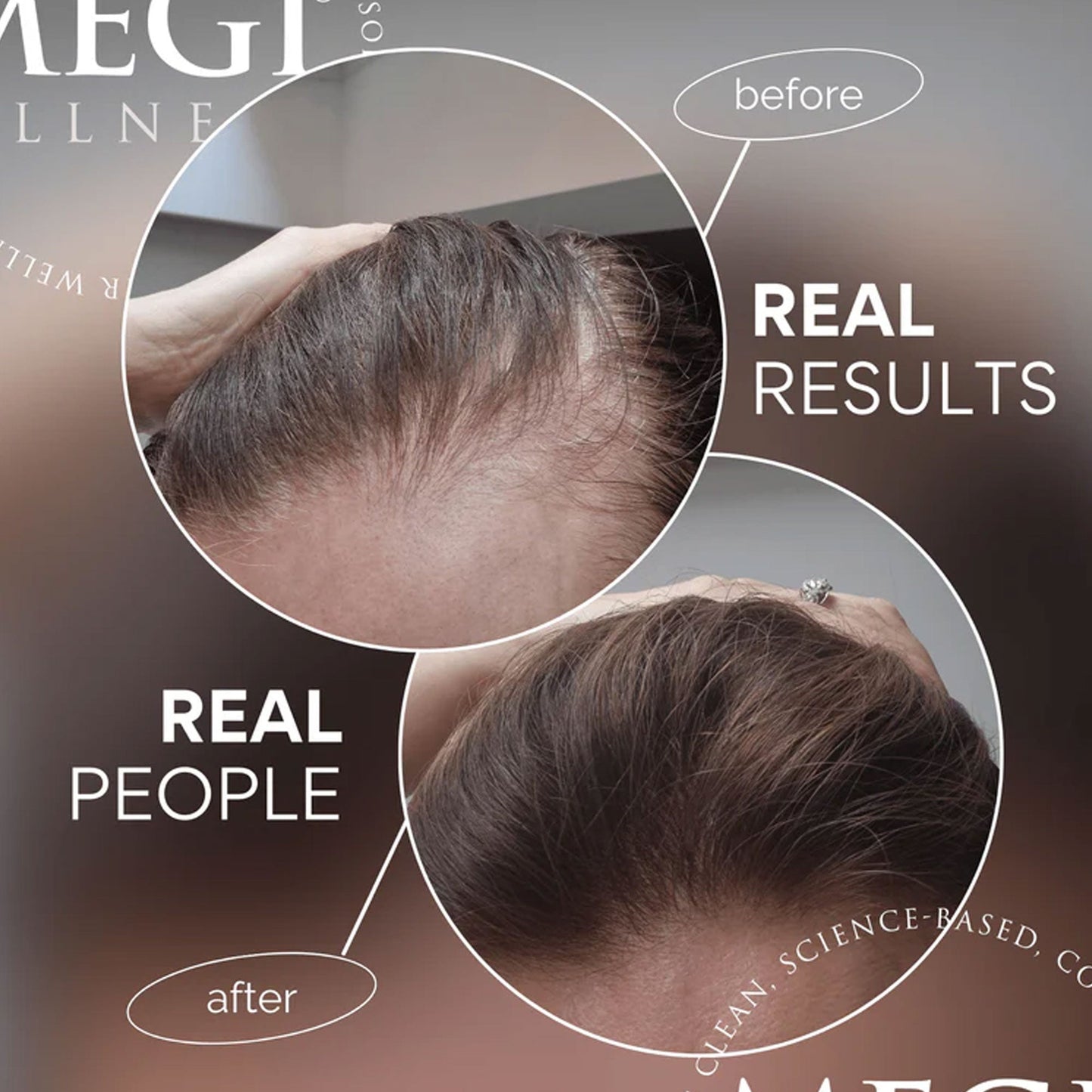 Megi Wellness Ultimate Hair Growth Set (Worth £118.96)