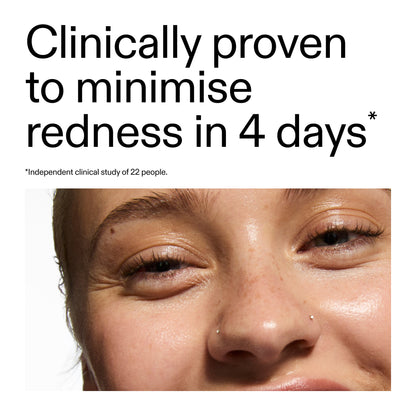 10% Azelaic Acid Serum for Redness Relief