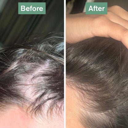 DR.VEGAN Hair Saviour Supplement